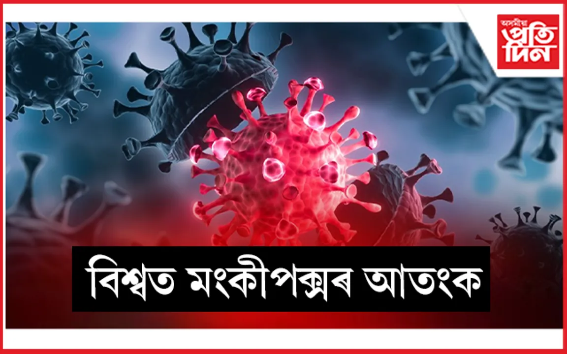 'মংকীপক্স'ক লৈ বিশ্বজুৰি জৰুৰীকালীন অৱস্থা ঘোষণা...